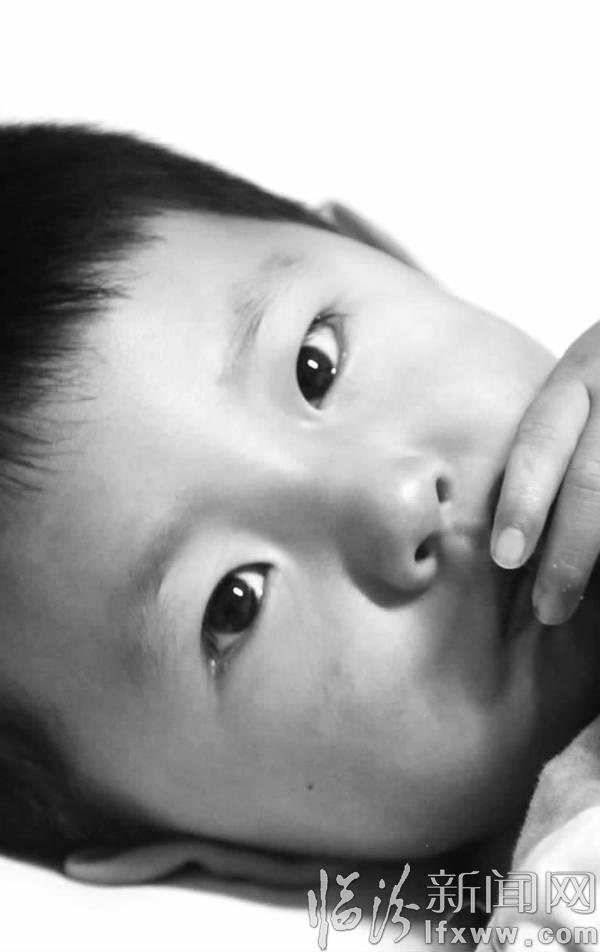 臨汾《微友匯聚愛心 救助燒傷女童》后續